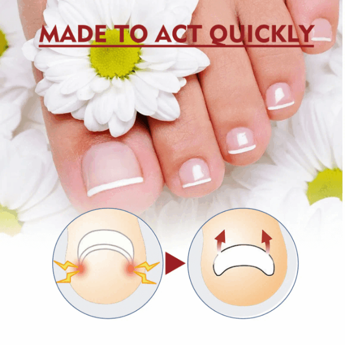Jaysuing Anti Paronichiya Relief Oil 10ml - Image 2