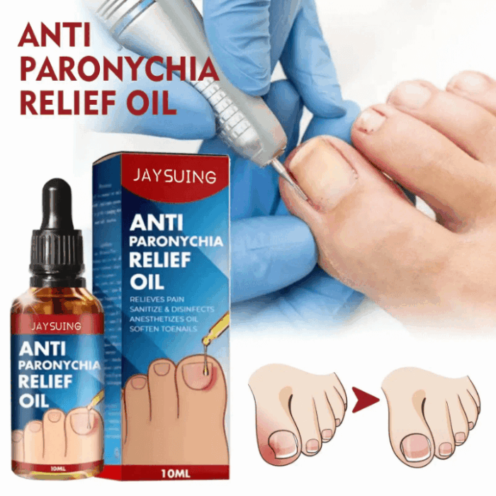 Jaysuing Anti Paronichiya Relief Oil 10ml - Image 1