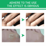 Jaysuing Active Corn Remover Serum 10ml - Image 3