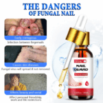 Jiaweishi Herbal Antibacterial Nail Solvent Serum 10Ml - Image 9
