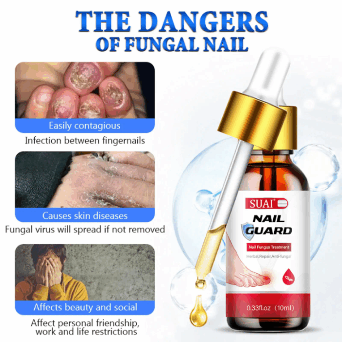 Jiaweishi Herbal Antibacterial Nail Solvent Serum 10Ml - Image 9